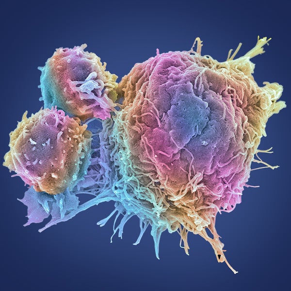 Cancer cell