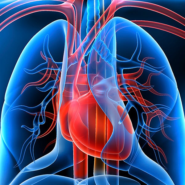 Cardiothoracic Surgery