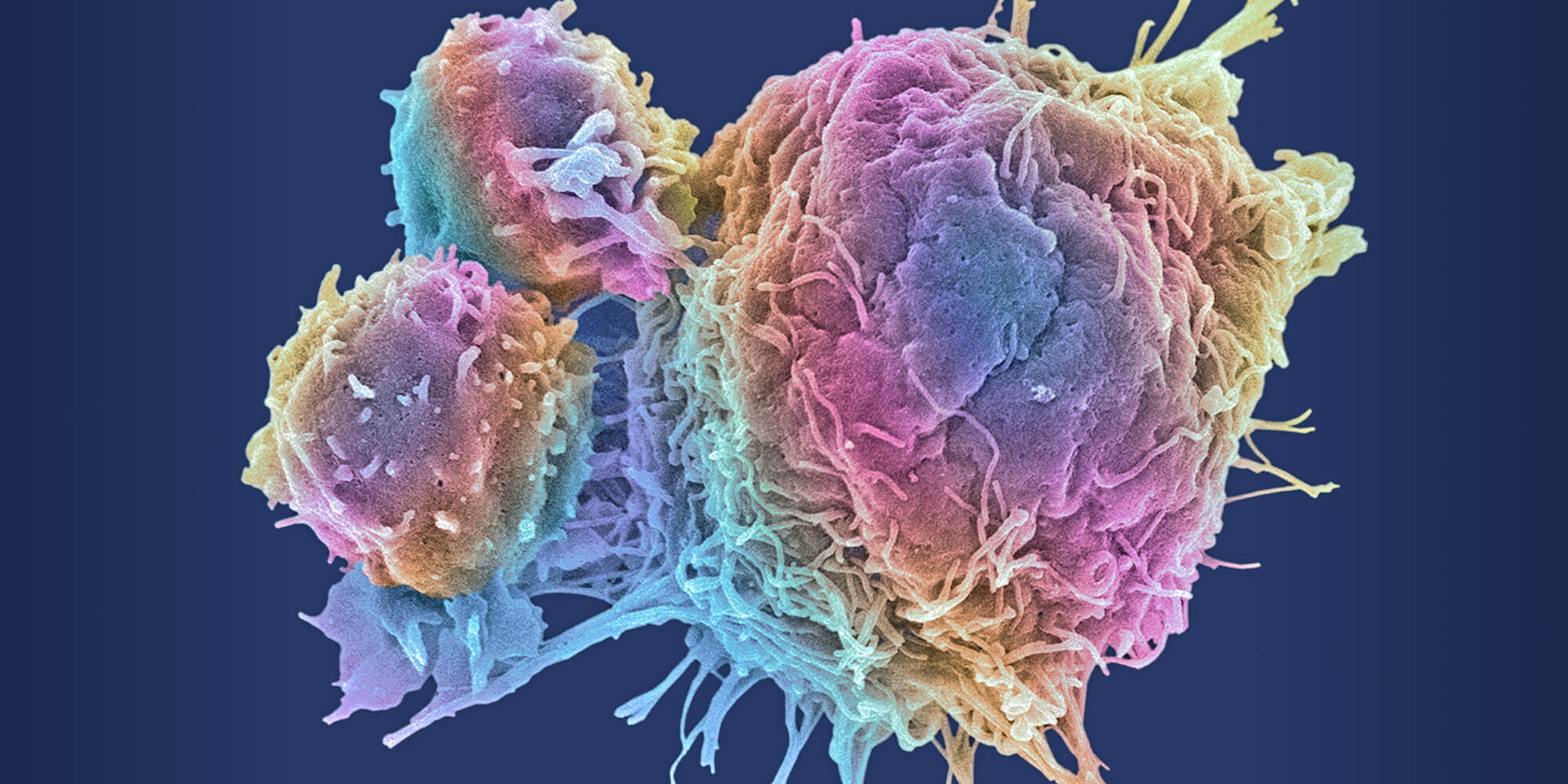 Cancer Cell Image