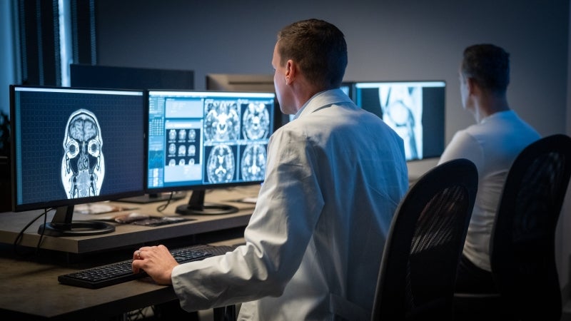 Specialist examining brain x-rays