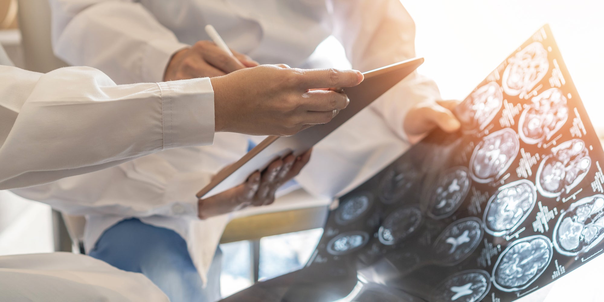 Doctors looking at neurology scans