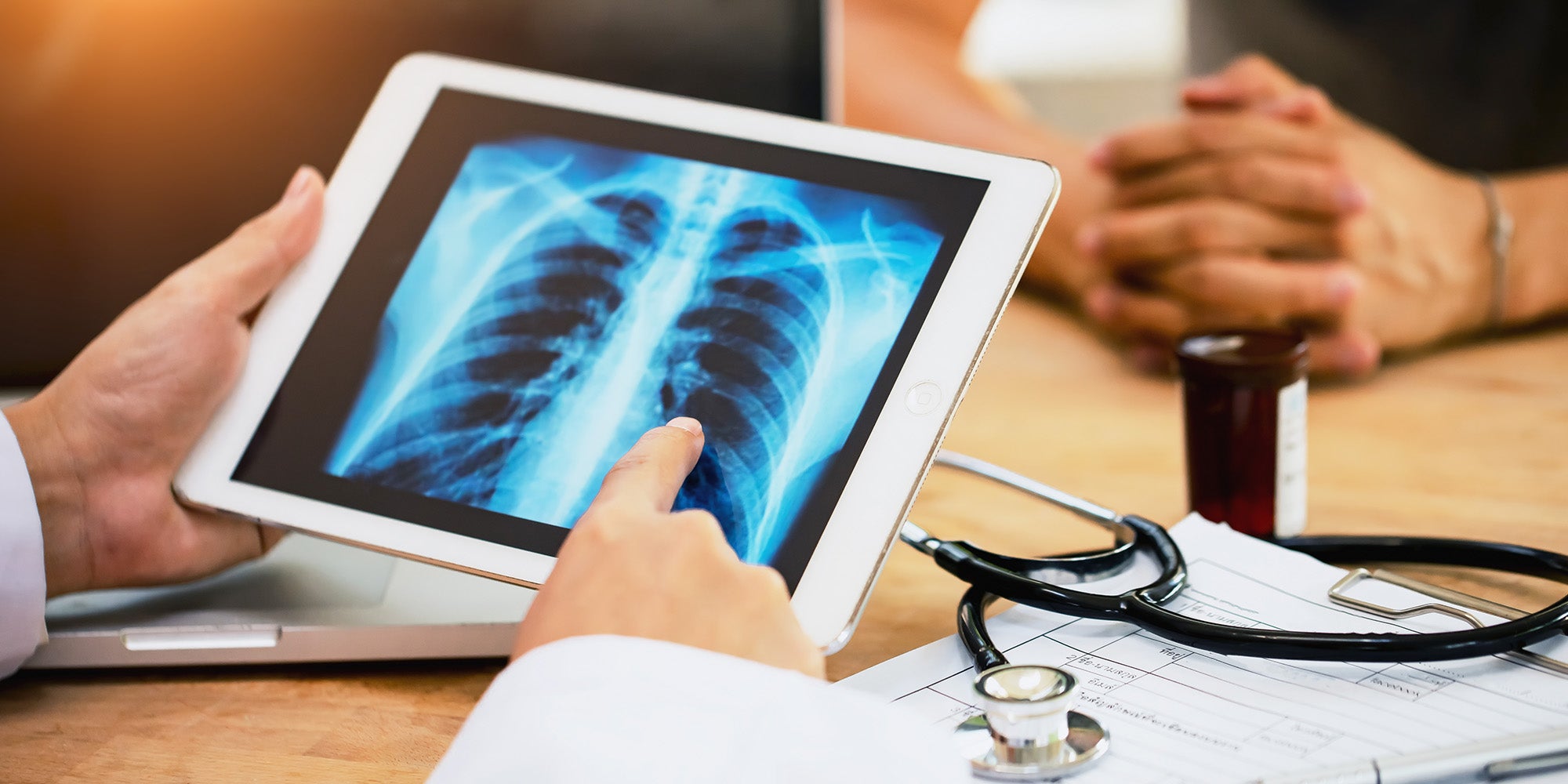 Doctor pointing to scan of lungs in front of patient