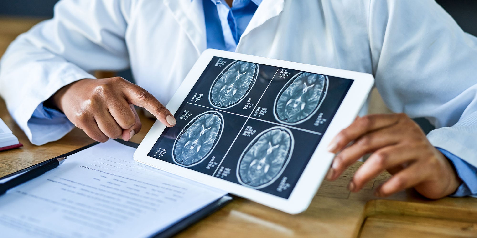 A doctor pointing at brain scan results on tablet