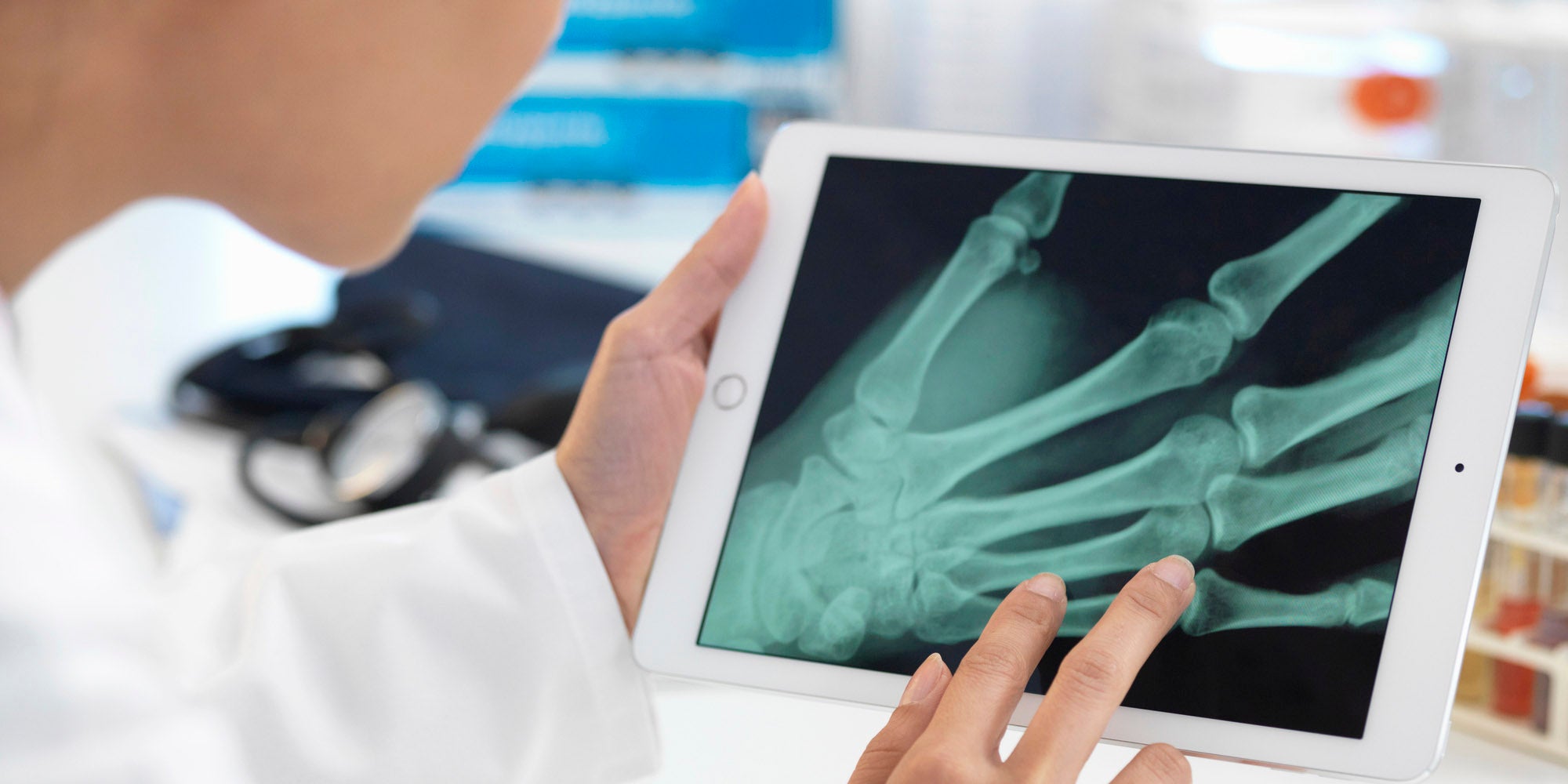 Doctor reviewing hand x-ray